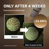 NIDA Black Rice Blackhead Exfoliating Serum