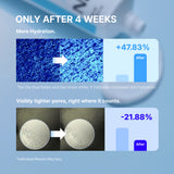 Crema humectante definitiva NIDA Youthful Formula™ 