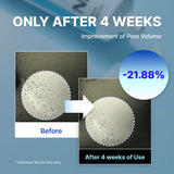 Crema humectante definitiva NIDA Youthful Formula™ 