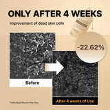 Suero exfoliante de arroz blanco NIDA para puntos blancos