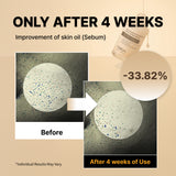 Suero exfoliante de arroz blanco NIDA para puntos blancos