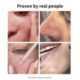 Paquete dúo de sueros exfoliantes blancos y negros NIDA 